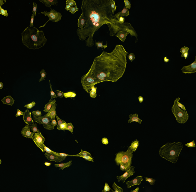 Green leaflike  structures glowing and floating in black.