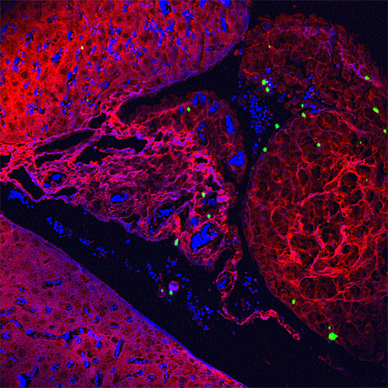 fluroescing nanoparticles in tissue