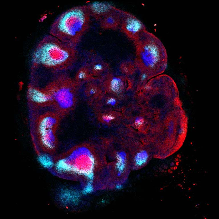 fluorescent cells in a lymph node