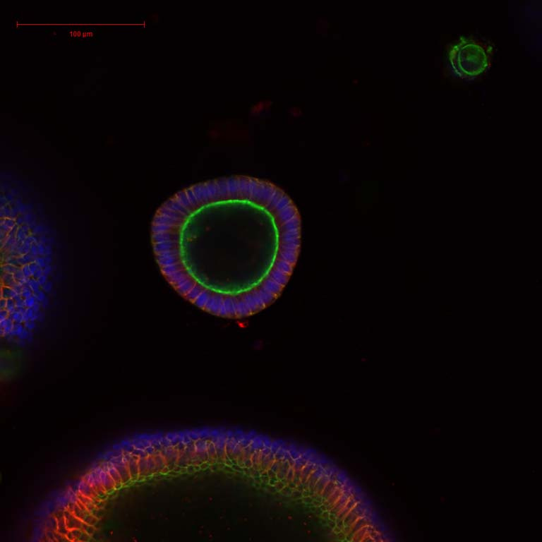 rings of cells in endometrial organoids