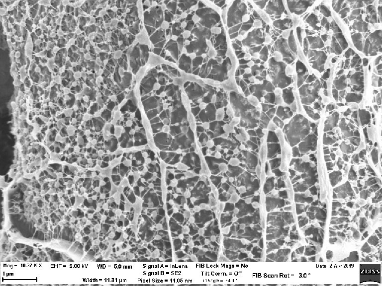 cryo-E-M view of a hydrogel mesh