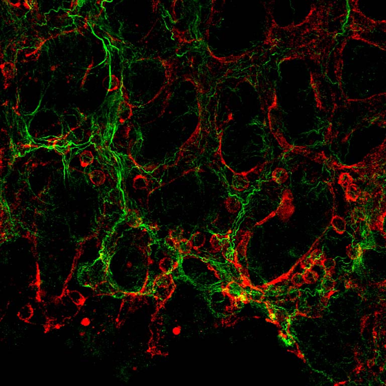 a network of blood vessels and protein fibers