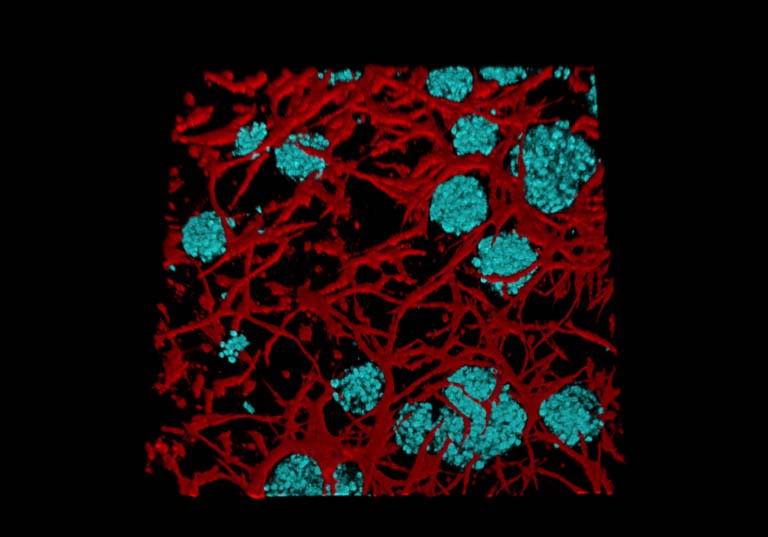 red vessels surround blue cells