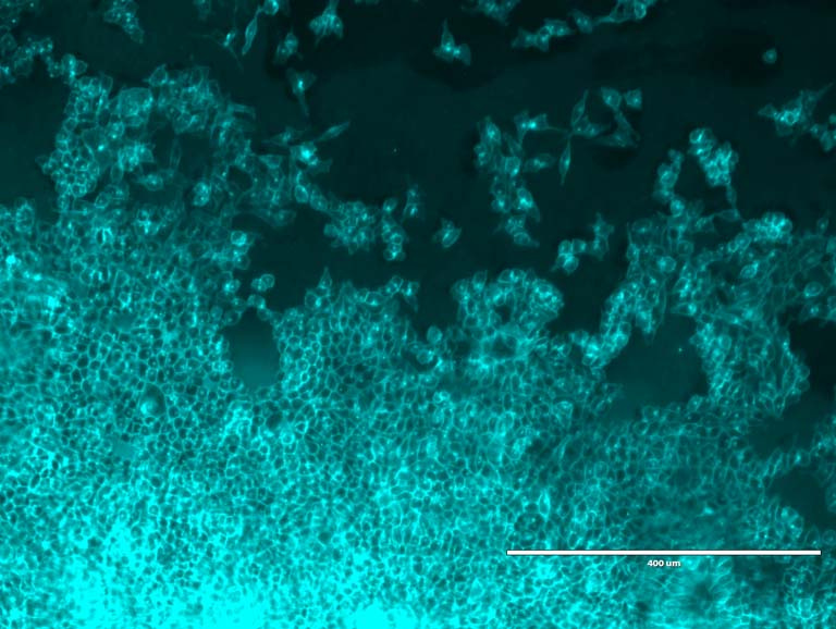 intestinal cells in cyan