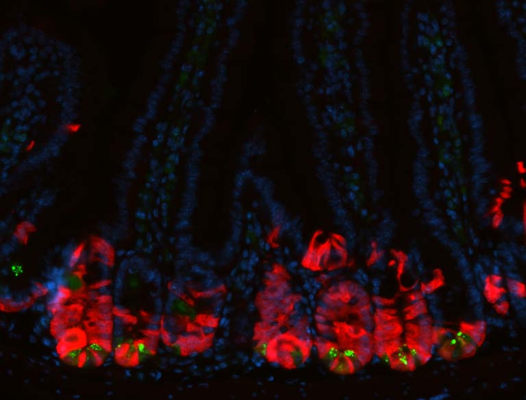 intestinal cells marked in red, blue, and green