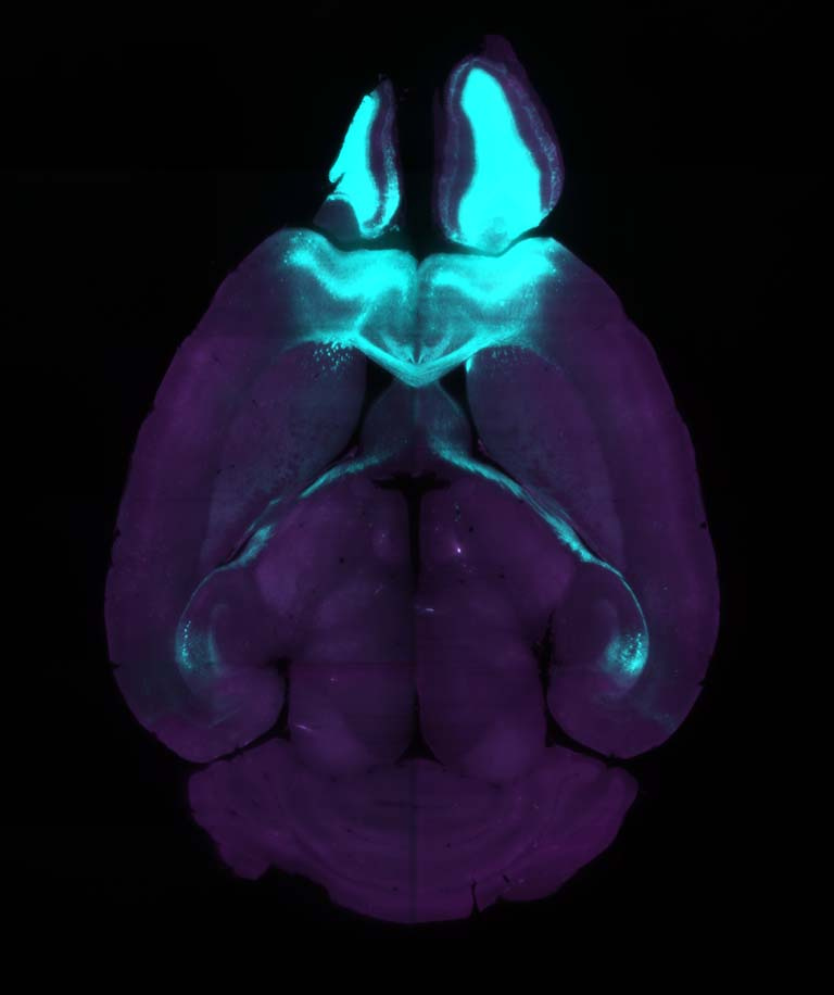 top view of a brain in purple, with cyan-marked regions at the top of the image