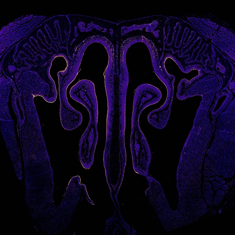 cross-section of a nasal passageway lined with brightly colored vaccine particles