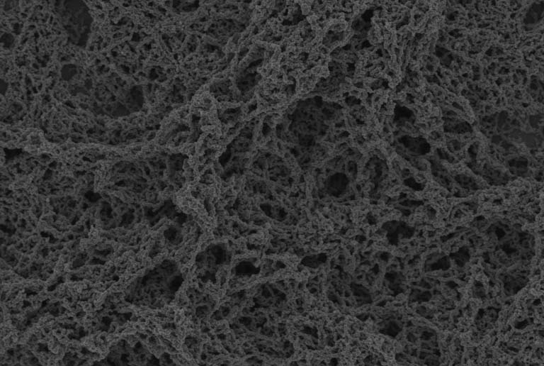 field of overlapping long thin chains of spongy-looking structures