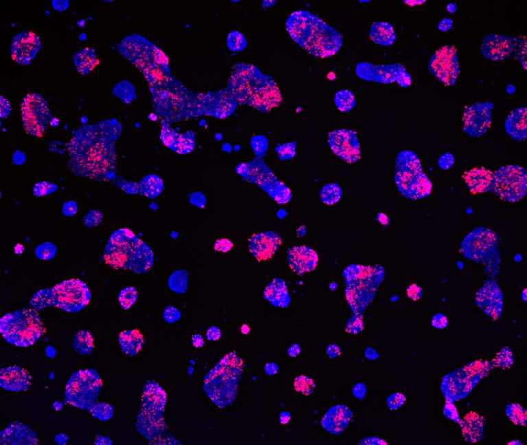 clusters of red and blue cells glow against a black background