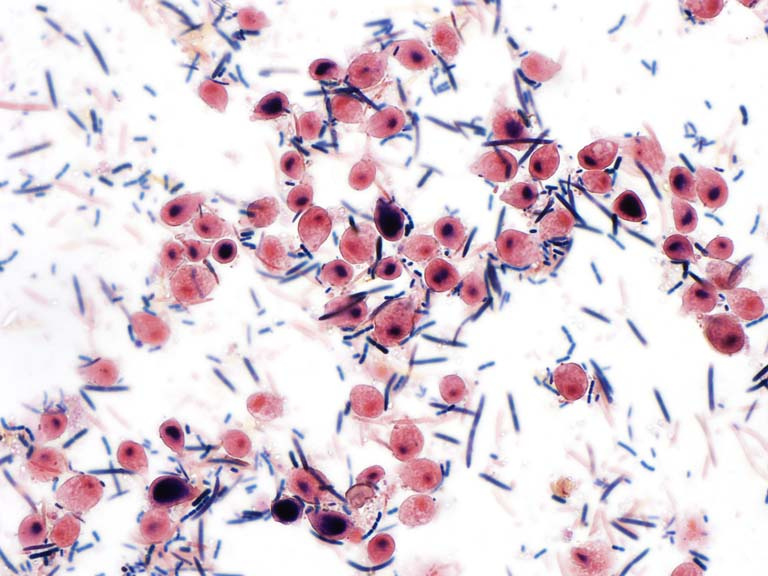 pink and purple-stained cells across a white field with blue lines scattered between them