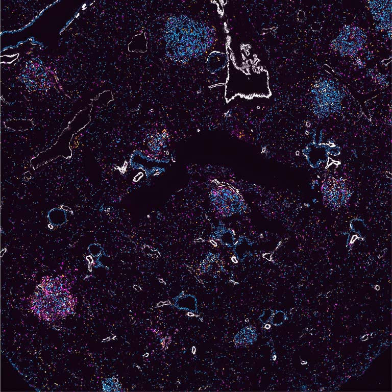 stained cells cluster within lung tissue