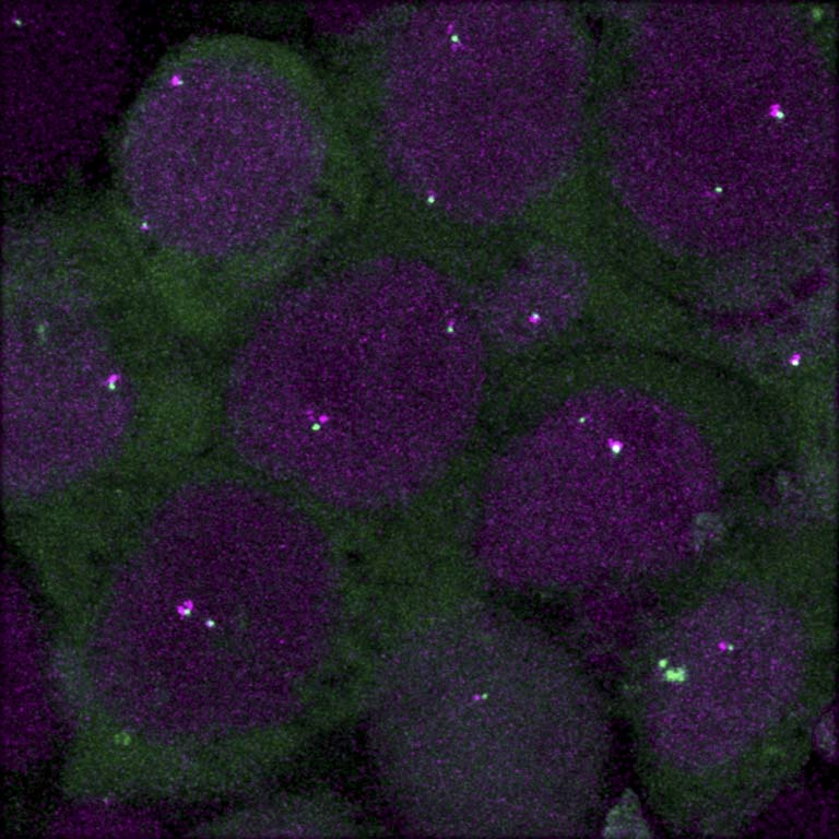 fuzzy purple cell structures with fuzzy green material surrounding and glowing spots within them