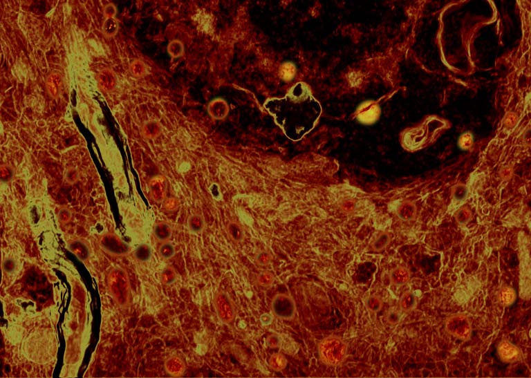 Cells colored red and yellow fill a horizontal field. Yellow stripes outlined with green cut across the lefthand side while swirls of black and red dominate the top