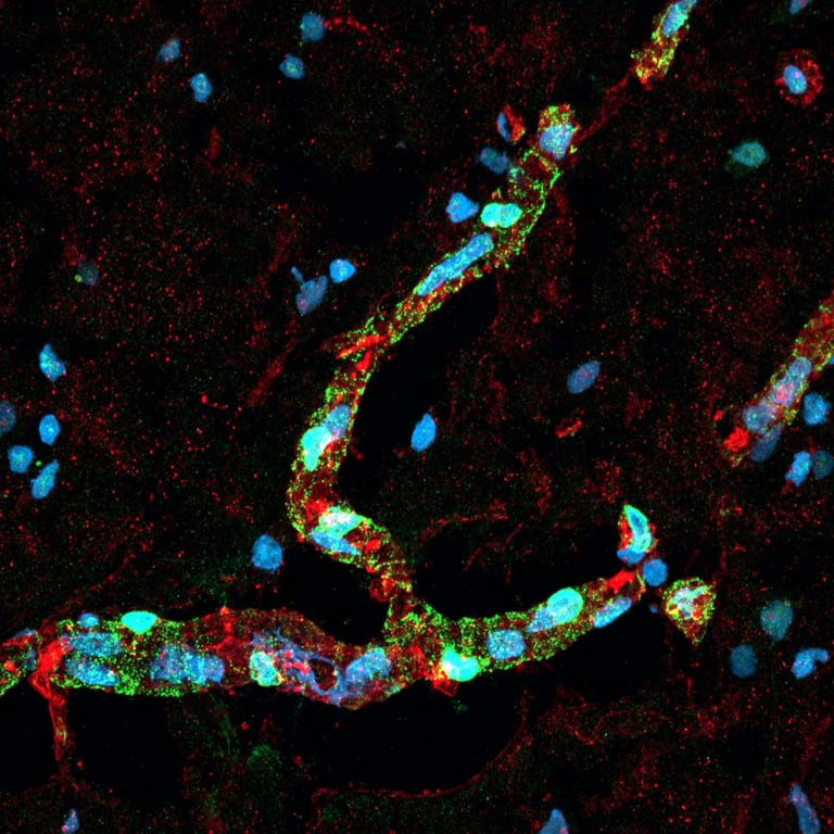 blue and green cells fill and surround long branching blood vessels