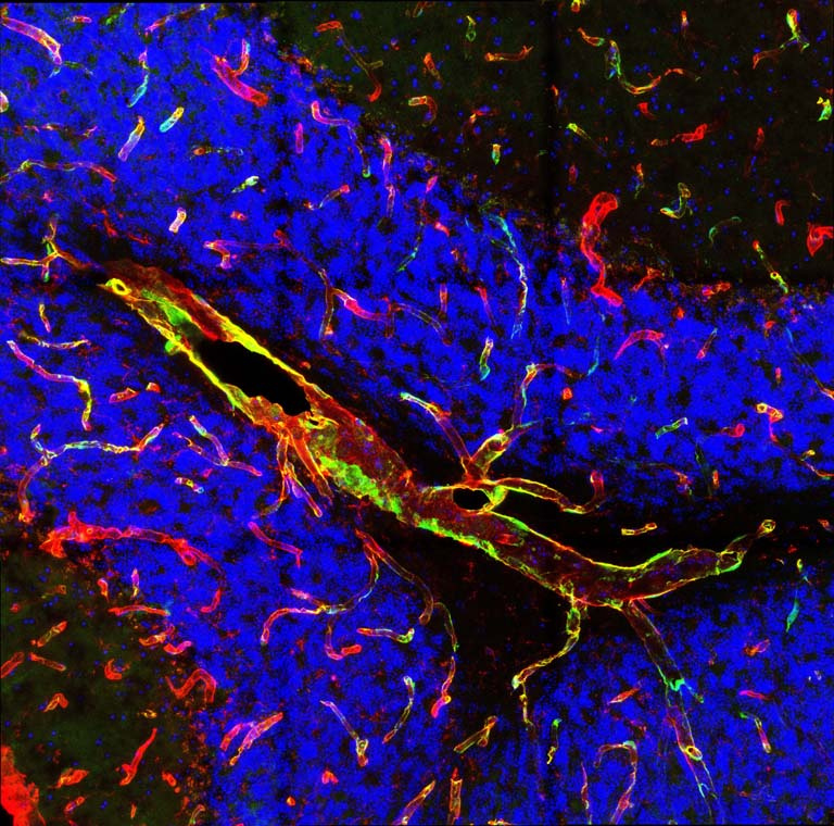 a close-up view of blue-stained cells against a wispy collection of elongated cells