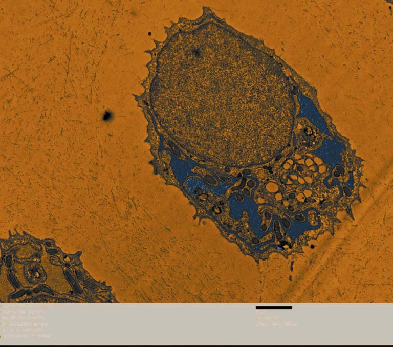 close-up view of a cell containing a large nucleus with various organelles to the lower right. The cell is in blue against an orange background.