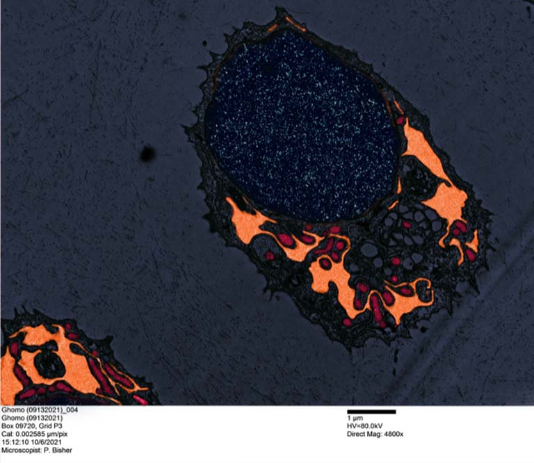 A close-up view of a cell containing a large nucleus in dark navy blue with various organelles in orange and deep magenta to the lower right. A second cells peeks up from the lower left corner. Microscopy information is below.