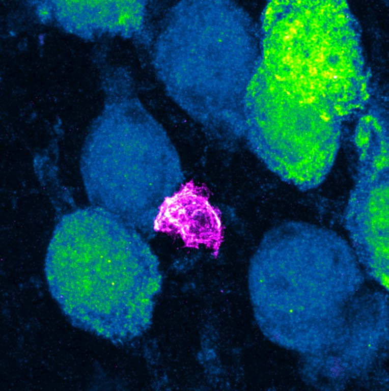 an irregularly shapes pink cell appears to float between more massive globular blue and green cells