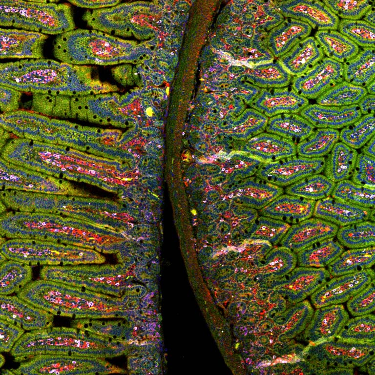 two lobes of green cells in long worm-like clusters split the field, interspersed with red and white spots and squiggles