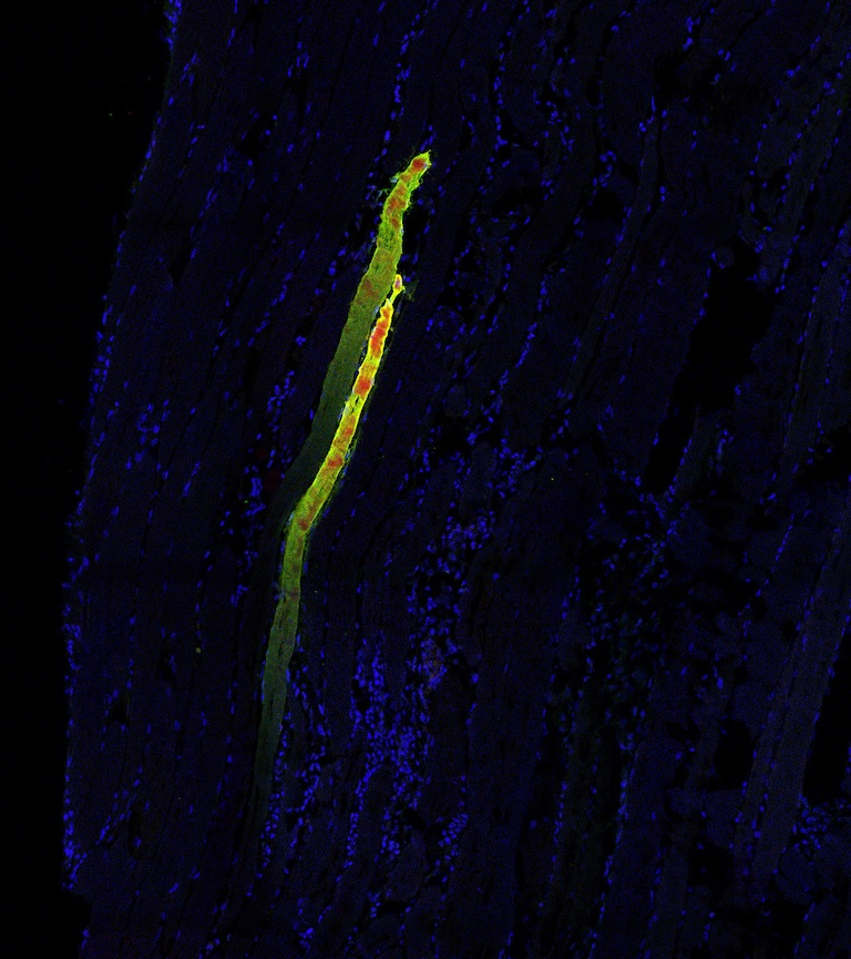 yellow worm-like columns against a wide river-like stretch of blue cells. Large red spots appear on the yellow structures.