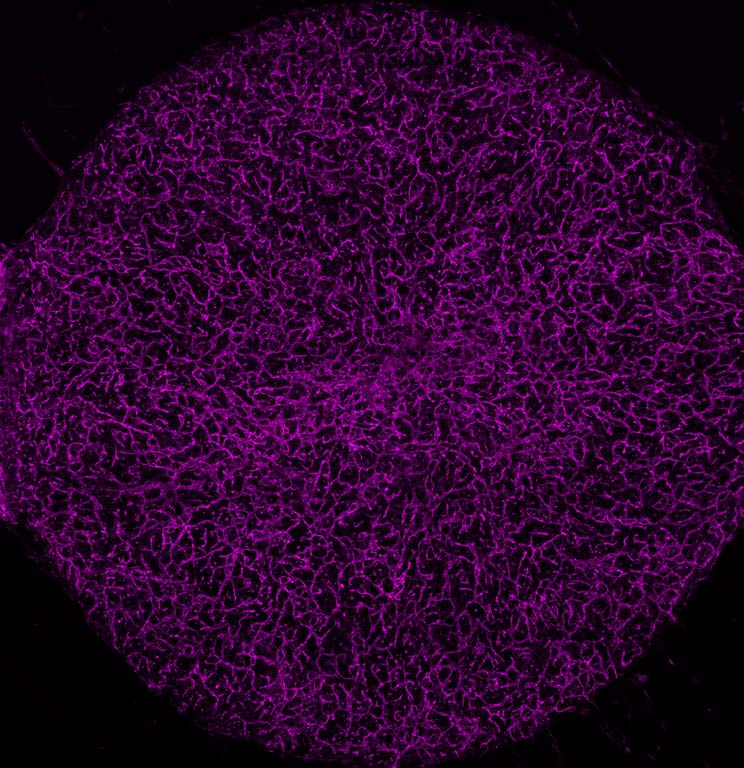 a full filled-in circle of thin mesh-like magenta cells against a black background