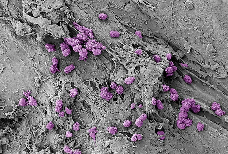 a gray clay-like field with clusters of round, ridged purple cells scattered throughout