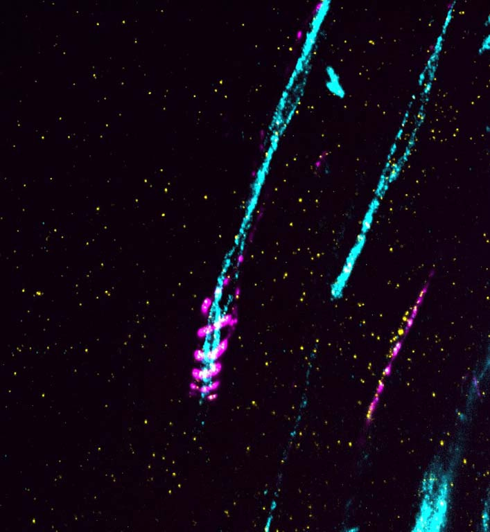 a curling protein (in magenta) spirals around a long thin bundle of axons (in cyan)