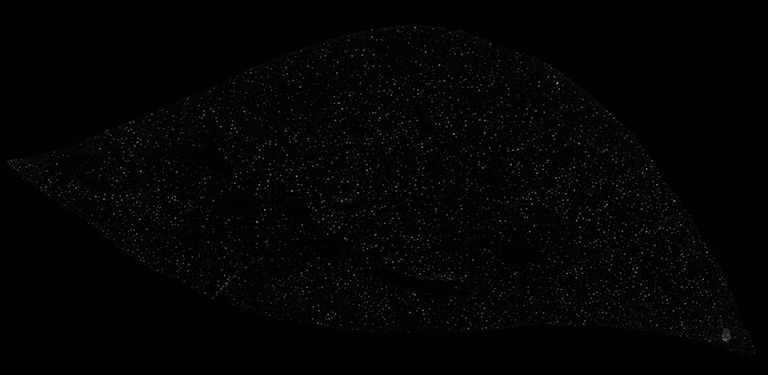 Liver structure with grey dots in a black background