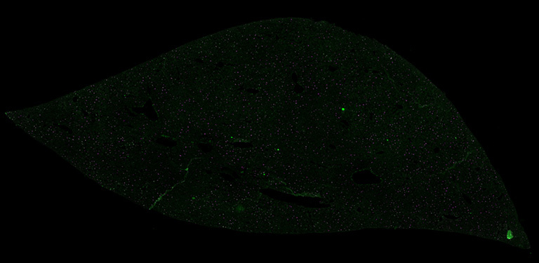 Liver structure with green dots in a black background