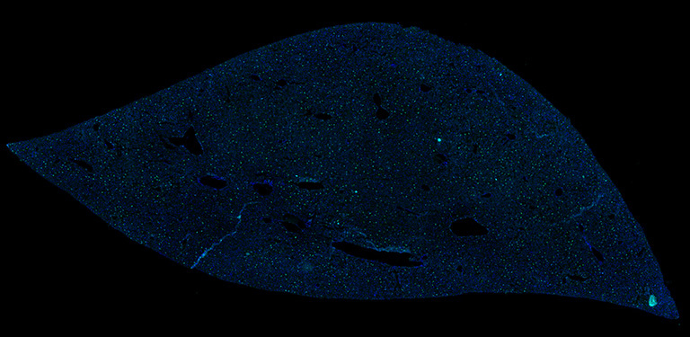 Liver structure with bright blue and green dots in a black background