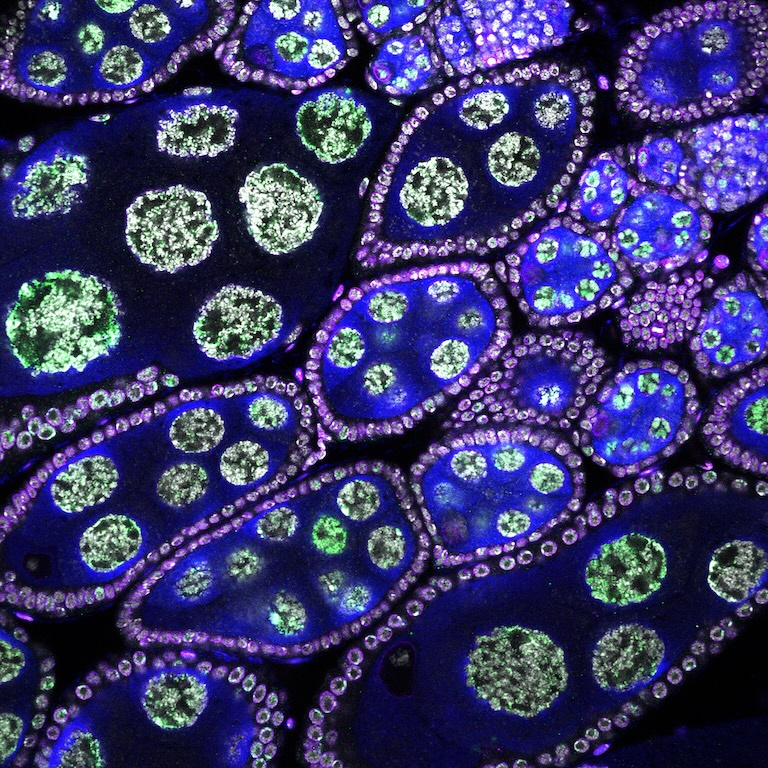 Green cells enclosed in blue structures with purple boundaries in a black background