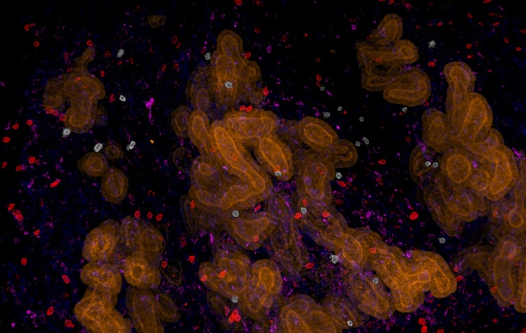 Three bright orange clusters with small scattered colorful cells in a black background