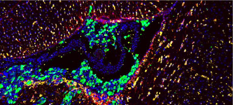 Complex colorful brain structures looking like circular clusters in a dark background 2