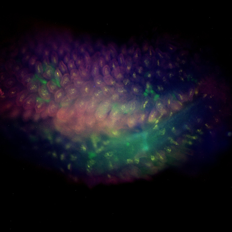 Tissue autofluorescence in a dark background