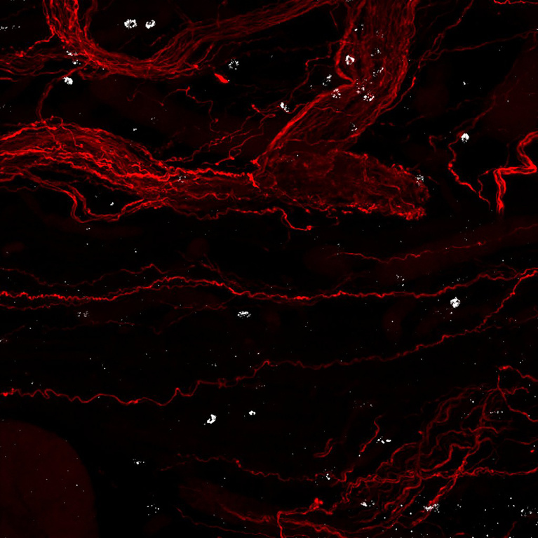 Red filament structures with white patches against a black background