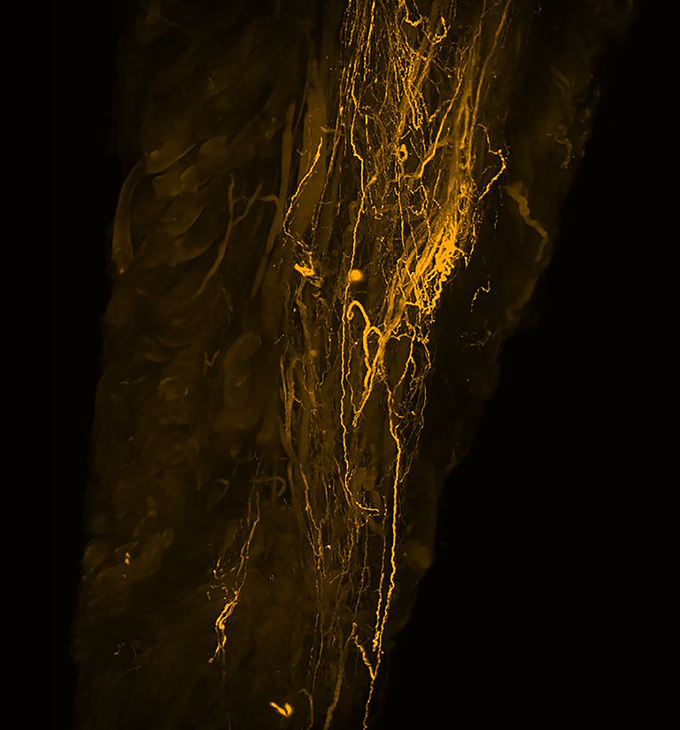 A column of fine gold filaments against a black background