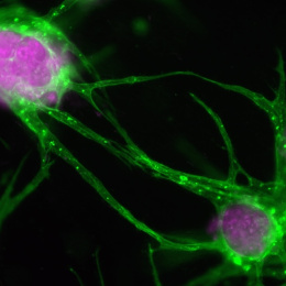 Glowing purple nuggets suspended in fluorescent green tendrils. 