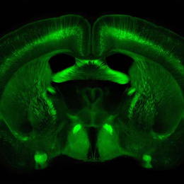 glowing green brain structure