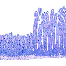 side-by-side comparison of two histology specimens