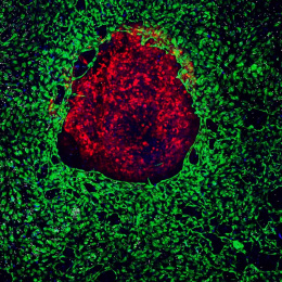 blood vessels and immune cells around a tumor