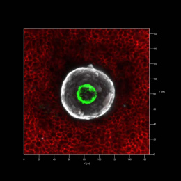 endometrial organoid (white and green with red surrounding)