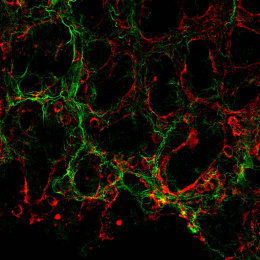 a network of blood vessels and protein fibers