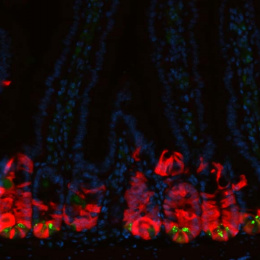 intestinal cells marked in red, blue, and green