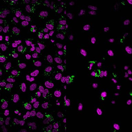 two panels of purple cells with green dots, zoomed out view on the left