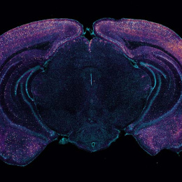 a central mass of brain tissue with arc-like tissue structures around it