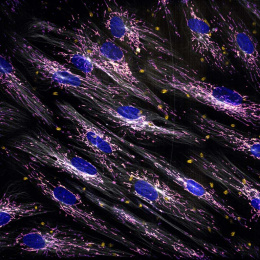 elongated compartments of blue nuclei surrounded by purplish grey fibers lie in diagonal stripes