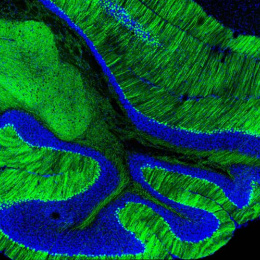 folds of brain tissue in striated blue and green