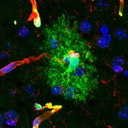 A cloud of green fluorescent cells surrounded by tubes of red and blue clusters. The middle glows more solid than the rest.