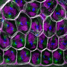 a honeycomb of white-outlined compartments enclose fuzzy magenta blobs being pulled by green and blue spindles