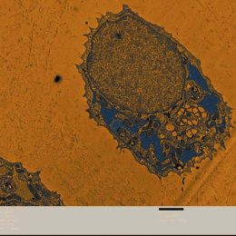 close-up view of a cell containing a large nucleus with various organelles to the lower right. The cell is in blue against an orange background.